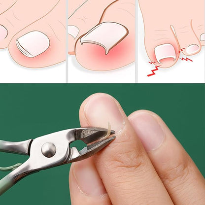 ProCare™ | La solution complète pour un soin professionnel des ongles.