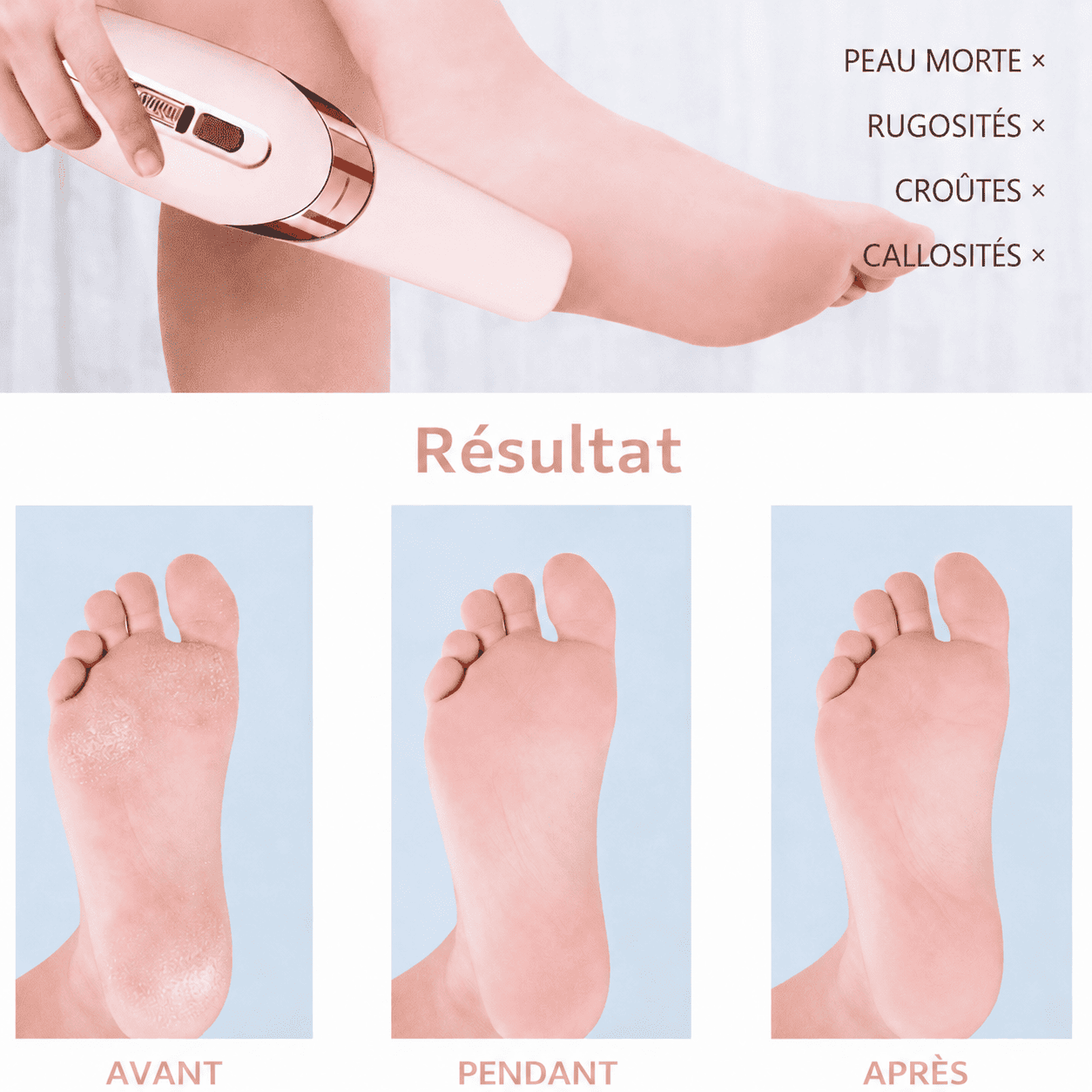PediCare™ | Prenez facilement soin de vos pieds à la maison.